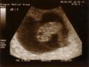 Susong Baby